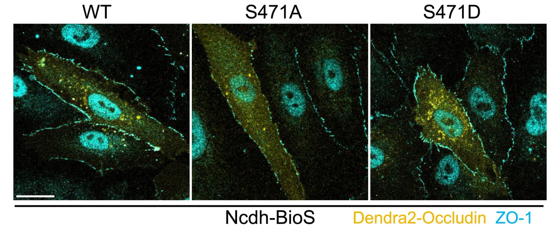 Open access visualization of Microscopy, ZO-1, TJs, BECs, Dendra2