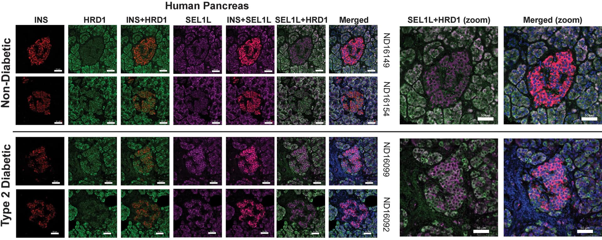 Open access visualization of Microscopy, Immunohistochemistry, Insulin, HRD1, SEL1L