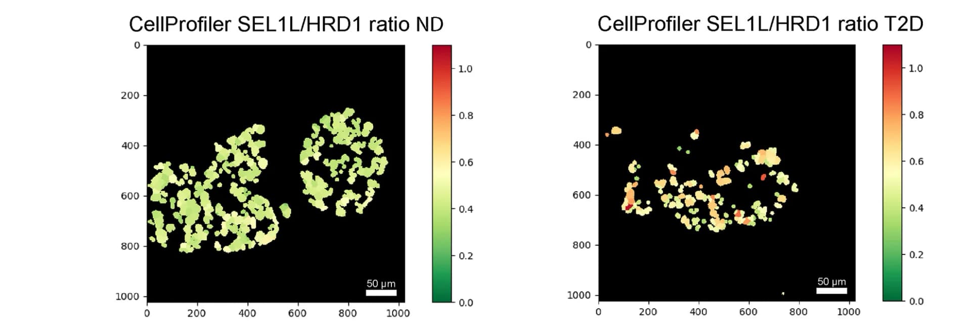 Open access visualization of Microscopy, CellProfiler, Beta Cells, SEL1L, HRD1