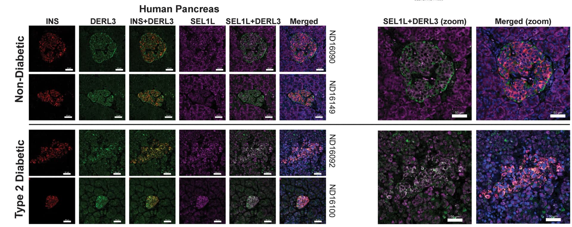 Open access visualization of Microscopy, Immunohistochemistry, Insulin, DERL3, SEL1L