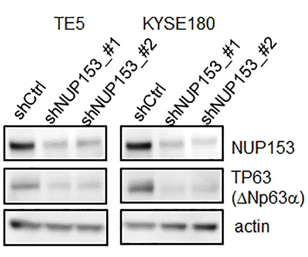 Open access visualization of Gel, Western Blotting, NUP153, ΔNp63α, SCC Cell Lines
