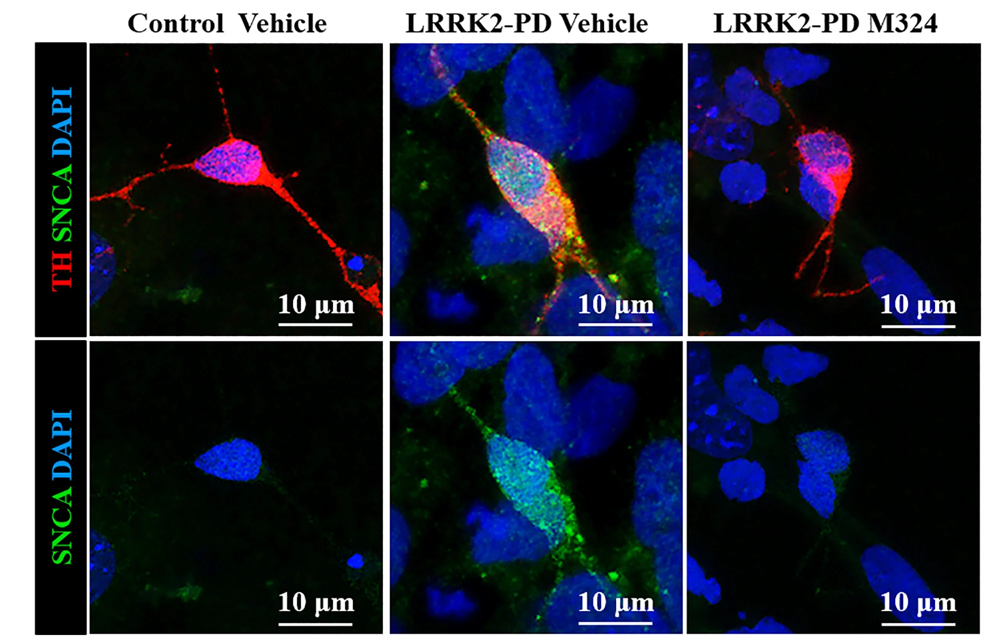 Open access visualization of Microscopy, Dopaminergic Neurons, Control hiPSC, LRRK2-PD hiPSC, Tyrosine Hydroxylase
