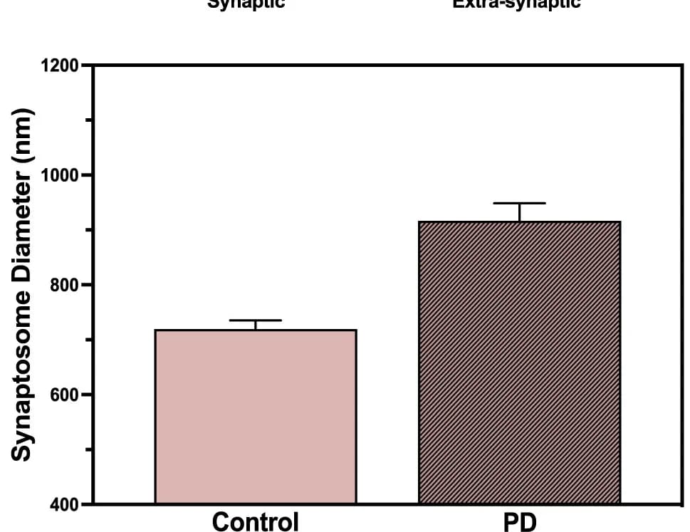 Open access visualization of Bar Plot, Error Bars, Synaptosome Diameter, AlphaSyn, Aggregate Length