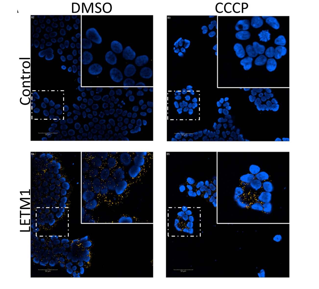 Open access visualization of Microscopy, Proximity Ligation Assay, HEK293 Cells, FLAG-USP30, LETM1 Antibody