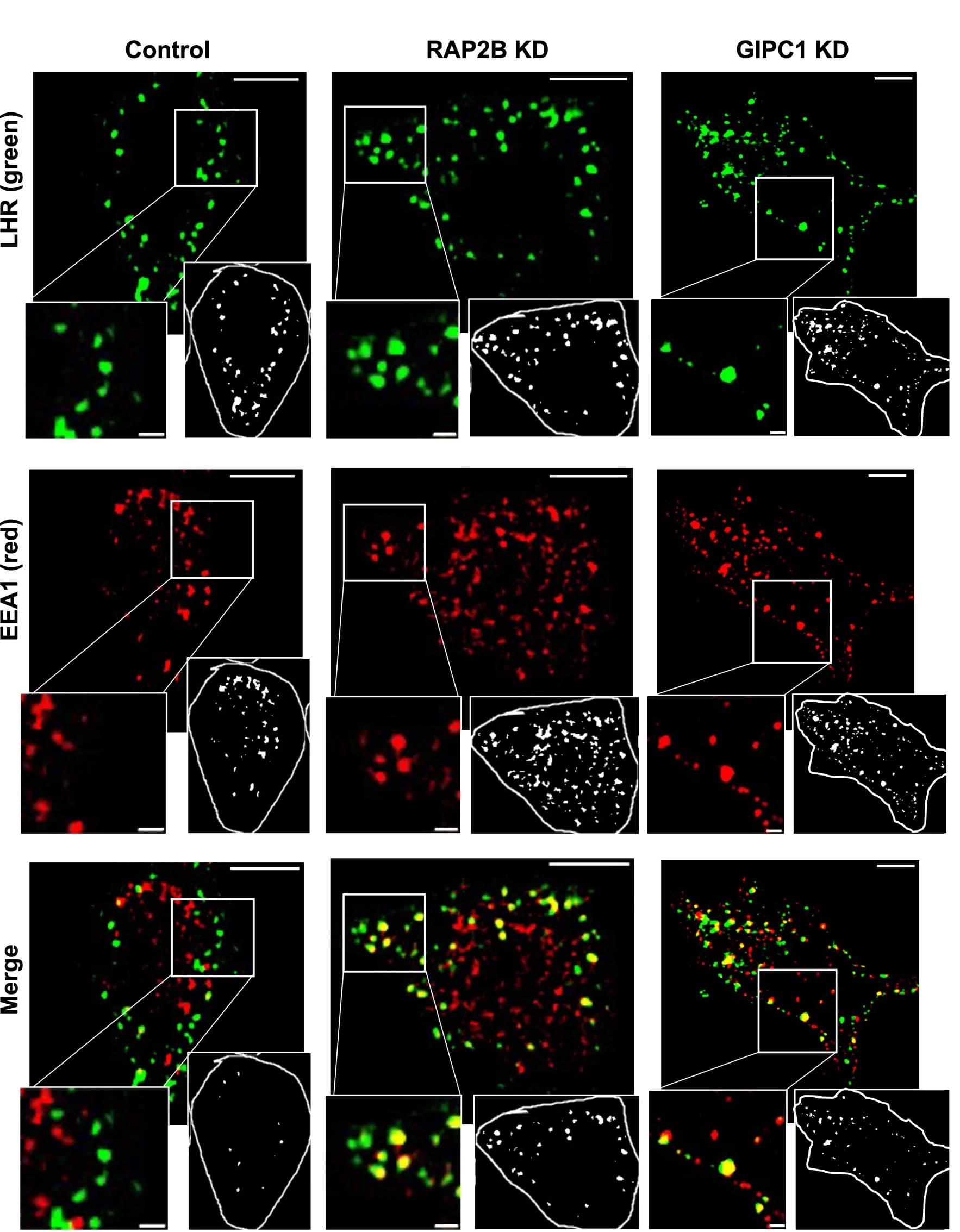 Open access visualization of Microscopy, Photo, Confocal Images, FLAG-LHR HEK293 Cells, Knock-Down Conditions