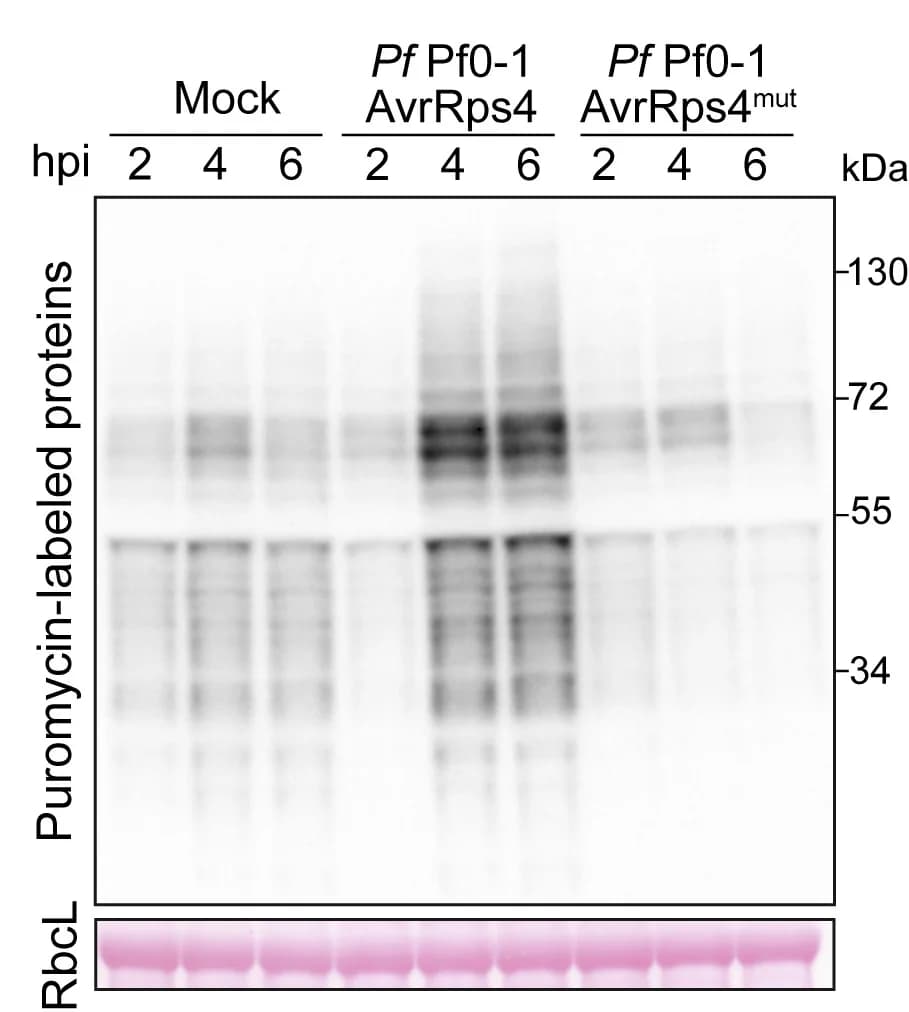 Open access visualization of Gel, Ws-2 ecotype, PfPf0-1/AvrRps4, PfPf0-1/AvrRps4mut, RuBisCo large subunit