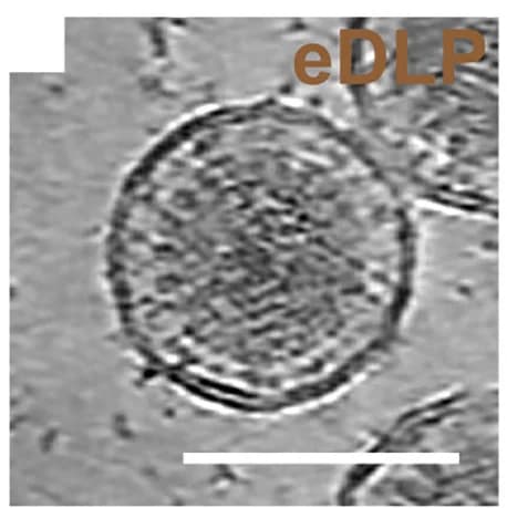 Open access visualization of Microscopy, Rotavirus Assembly, Intermediates, Close-Up View