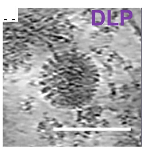 Open access visualization of Microscopy, Rotavirus Assembly, Intermediates, Close-Up View