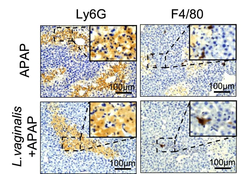 Open access visualization of Microscopy, Immunohistochemical images, Neutrophils, Macrophages, Liver