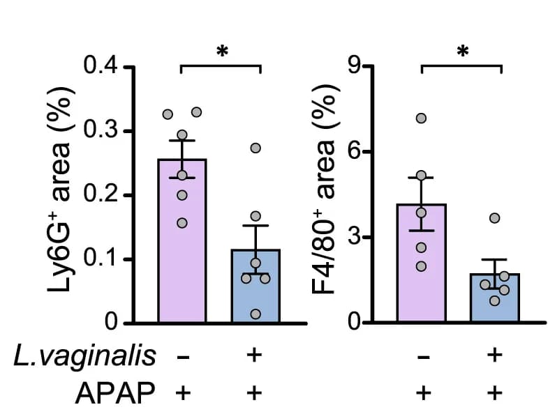 Open access visualization of Bar Plot, Error Bars, Immunohistochemical images, Neutrophils, Macrophages