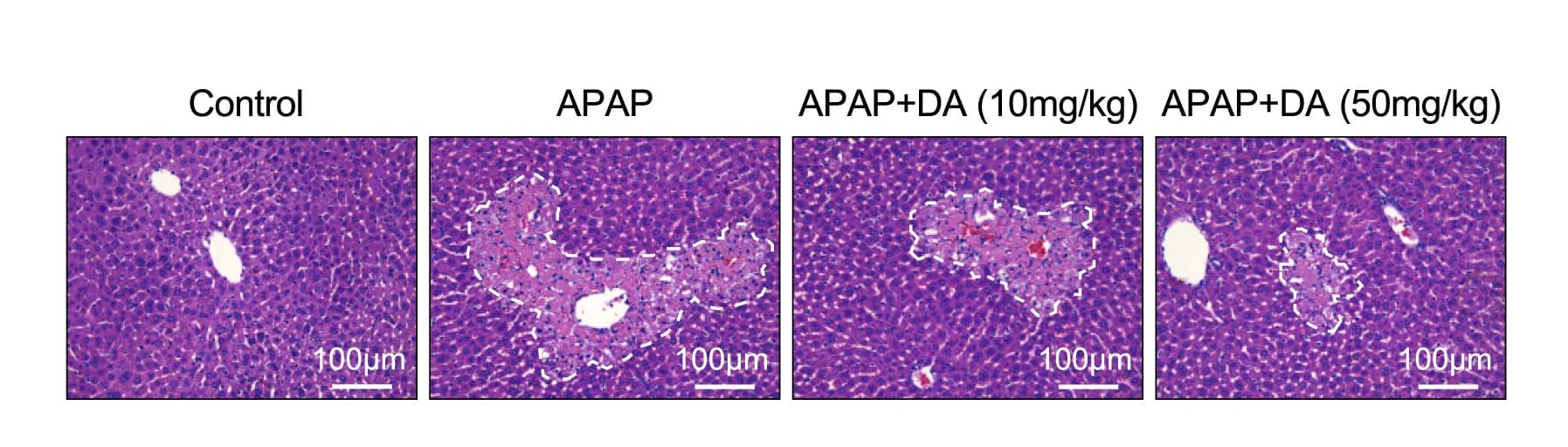 Open access visualization of Microscopy, H&E Staining, TUNEL Staining, Necrotic Areas, Cell Death