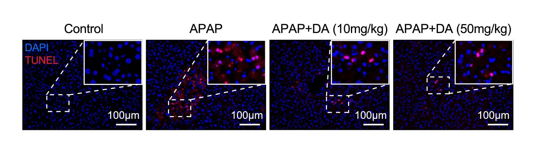 Open access visualization of Microscopy, H&E Staining, TUNEL Staining, Necrotic Areas, Cell Death