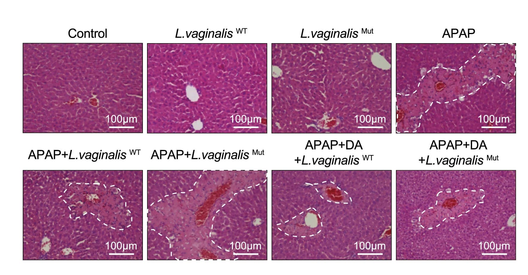Open access visualization of Microscopy, H&E Staining, TUNEL Staining, Necrotic Areas, Cell Death