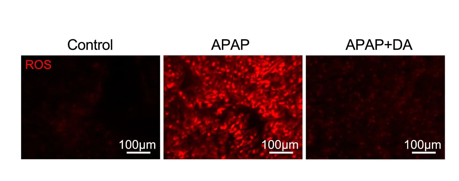 Open access visualization of Microscopy, Photo, ROS, Liver, Mice