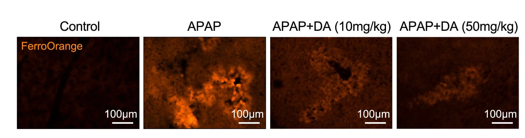 Open access visualization of Microscopy, Fe2+, FerroOrange, Fluorescent Probe, Liver