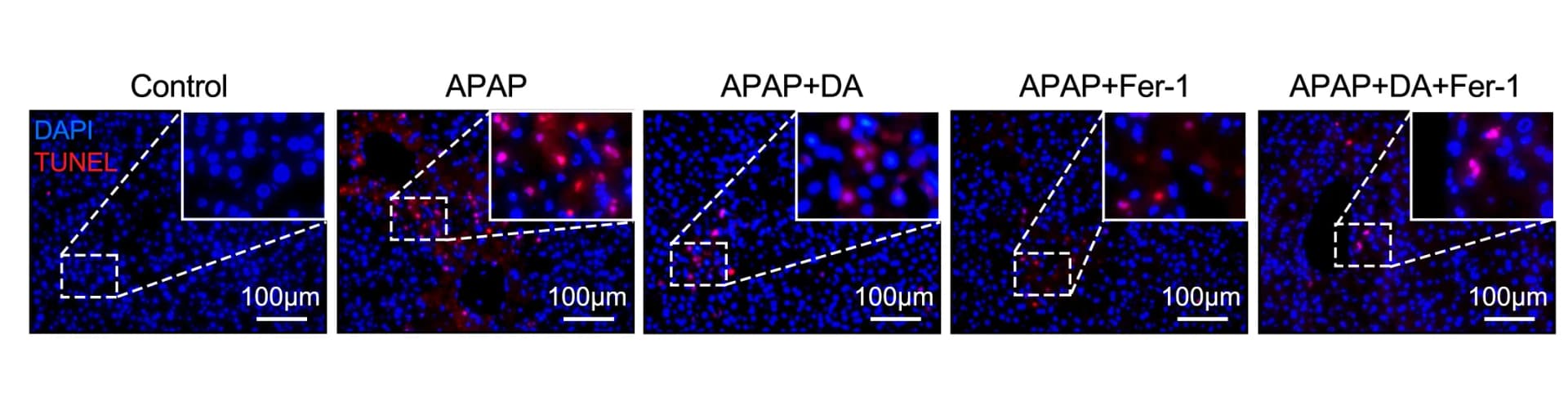 Open access visualization of Microscopy, TUNEL Staining, Cell Death, Liver, Mice