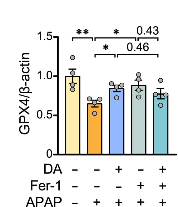 Open access visualization of Bar Plot, Error Bars, xCT, Primary Hepatocytes, APAP