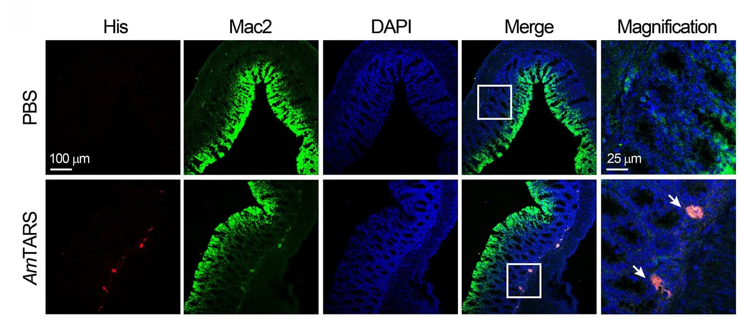 Open access visualization of Microscopy, Immunofluorescence Staining, Macrophages, Colon