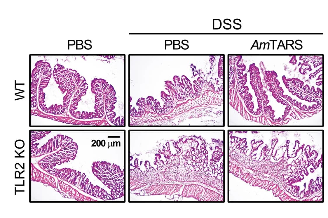 Open access visualization of Microscopy, Intestinal Epithelial Damage, H&E Staining