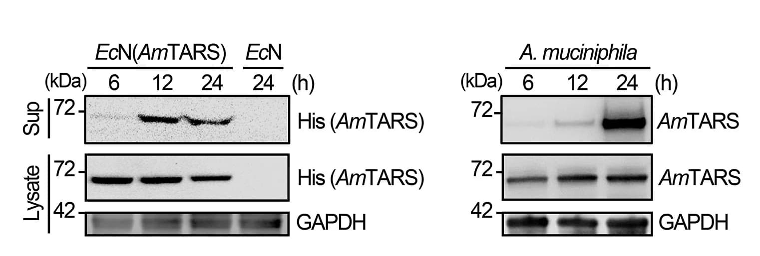 Open access visualization of Gel, Western Blot, EcN, A. muciniphila, AmTARS