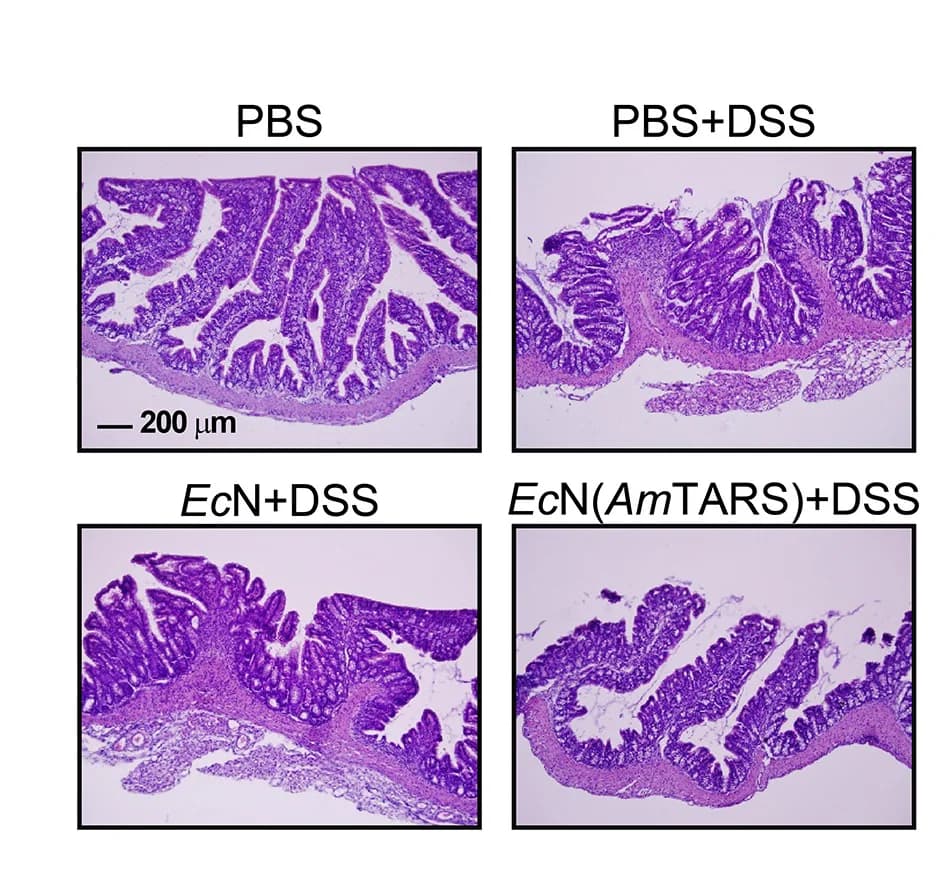 Open access visualization of Microscopy, DSS-induced Colitis, EcN, AmTARS, Intestinal Epithelial Damage