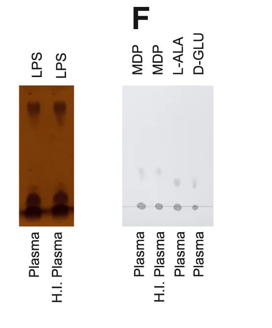 Open access visualization of Gel, SDS-PAGE, Proteobacteria LPS, Plasma