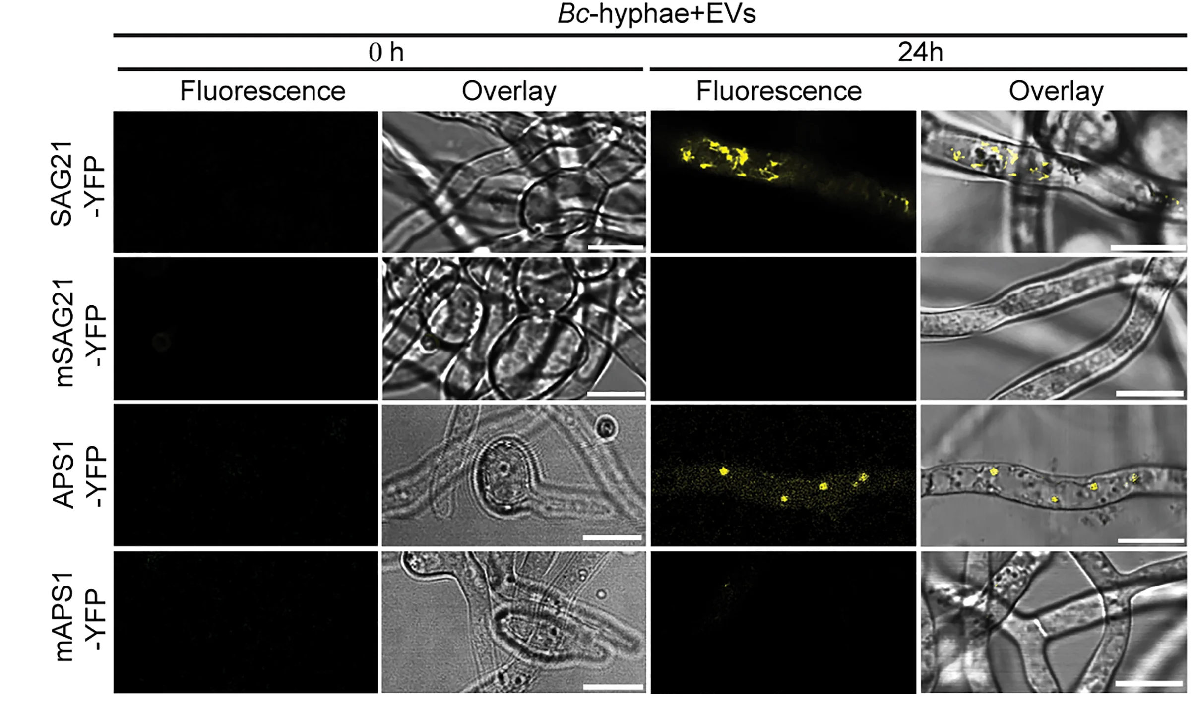 Open access visualization of Microscopy, Fluorescence Signals, YFP-Tagged SAG21, APS1 Proteins, Fungal Cells