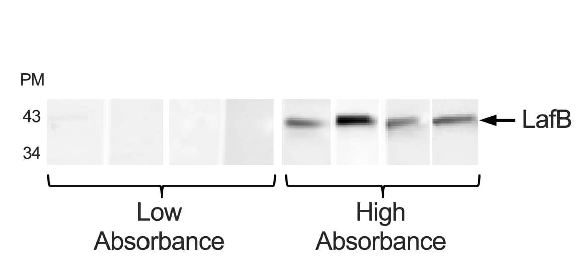 Open access visualization of Gel, Plasma Samples, ELISA, Immunoblotting, SDS-PAGE