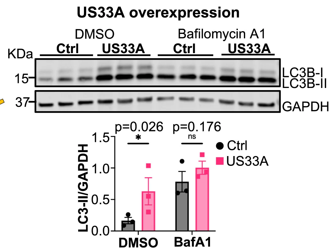 Open access visualization of Gel, Bar Plot, Error Bars, LC3B-II expression, HFFF-TERTs