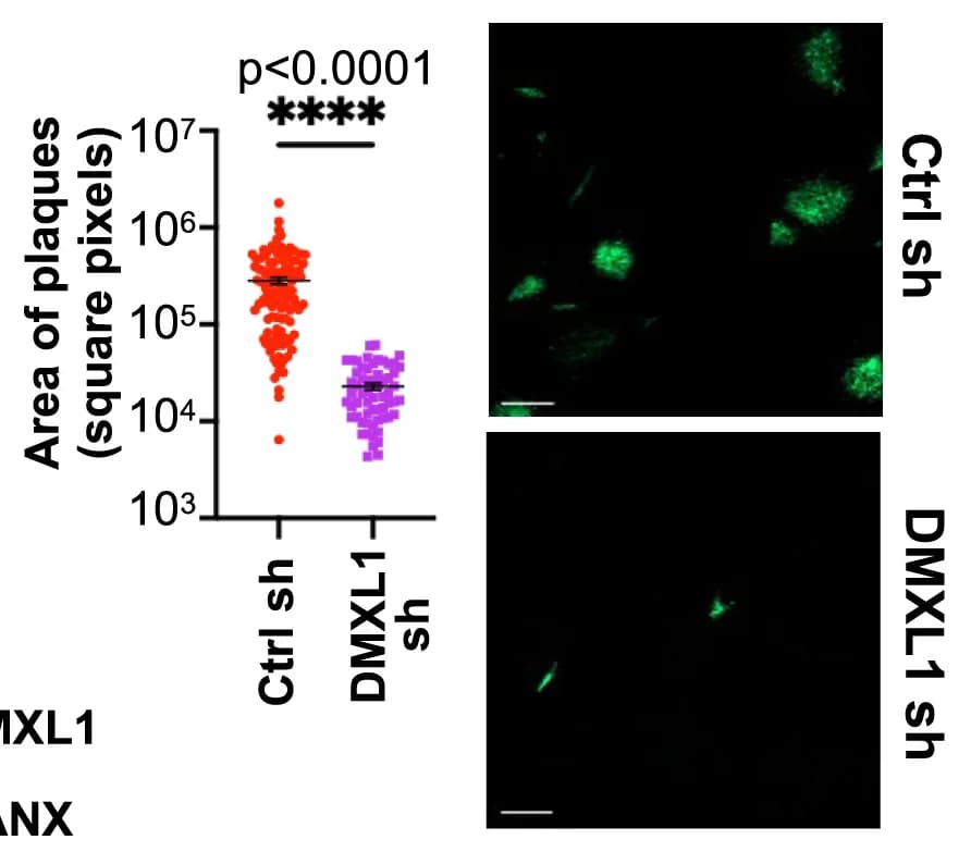 Open access visualization of Scatter Plot, Microscopy, Plaque Size, HCMV, Plaque Morphology
