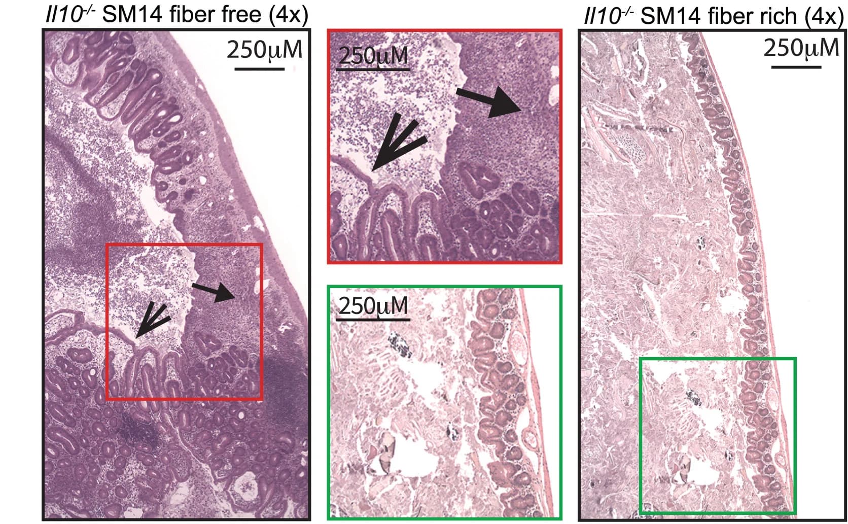 Open access visualization of Microscopy, Cecal Histology, Fiber-Free Diet, Fiber-Rich Diet, SM14 Colonization