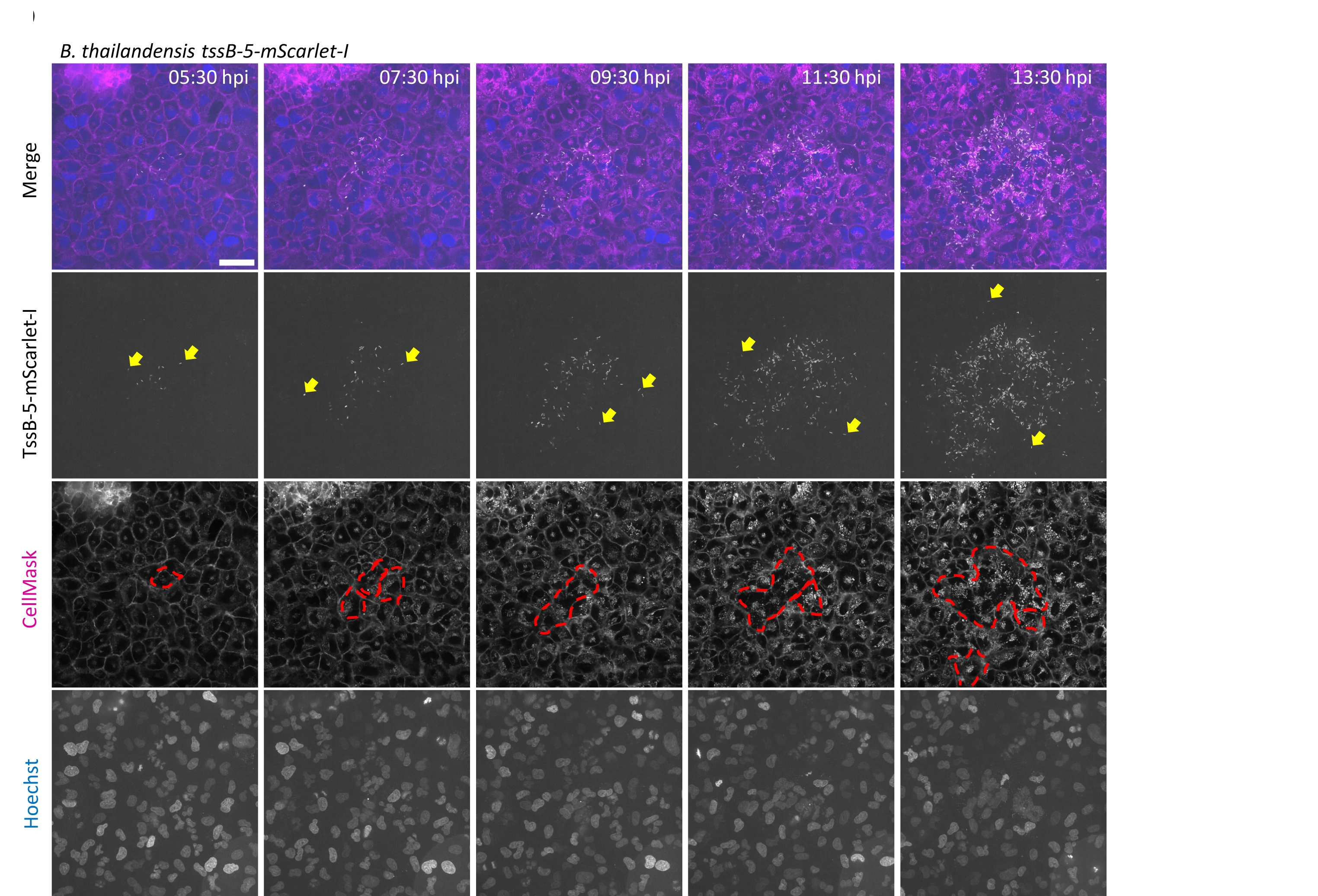 Open access visualization of Microscopy, Photo, A549 Lung Cells, B. thailandensis, TssB-5-mScarlet-I