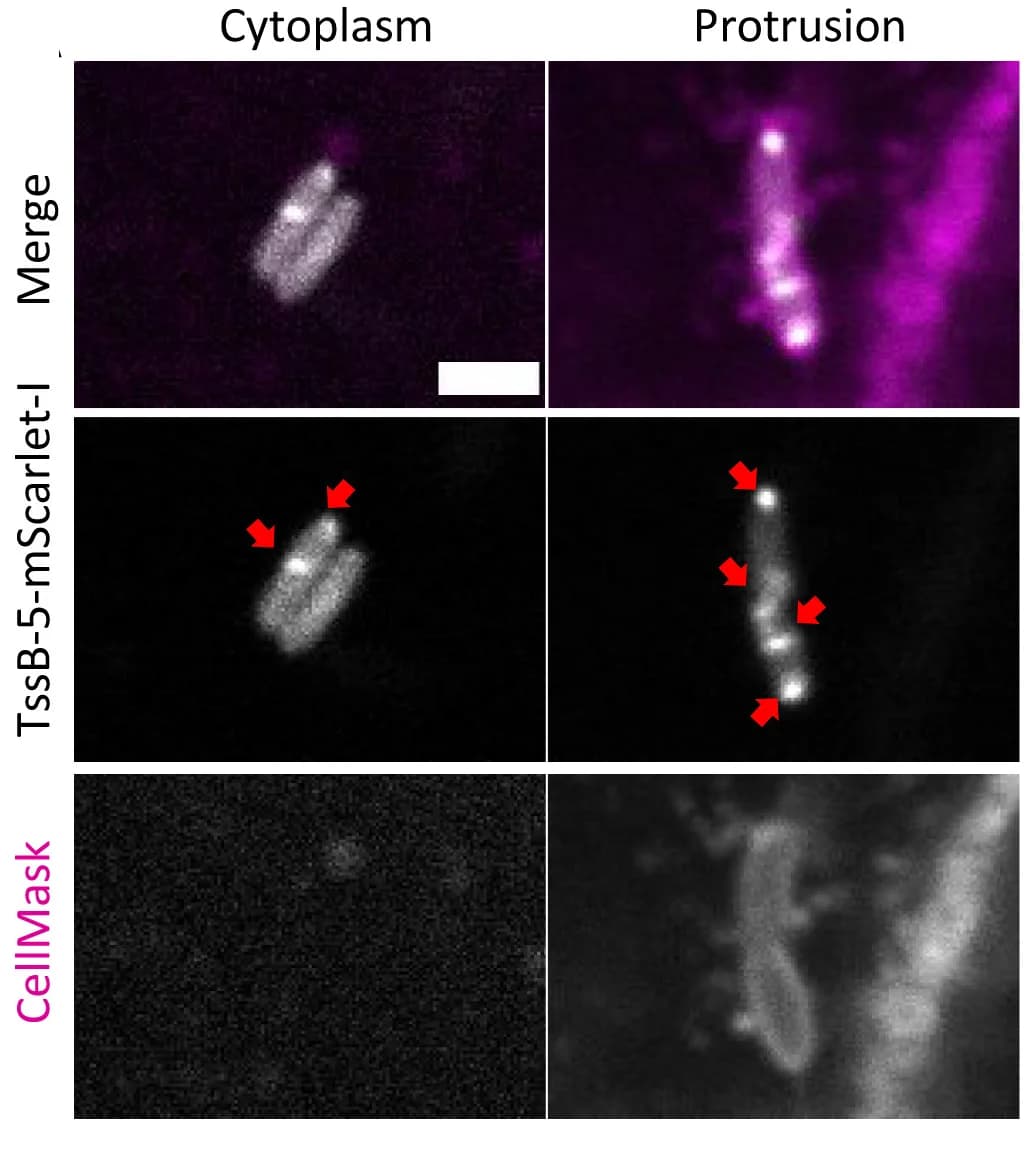 Open access visualization of Microscopy, T6SS-5 Assemblies, Bacteria, Host Cytoplasm, Host Membrane