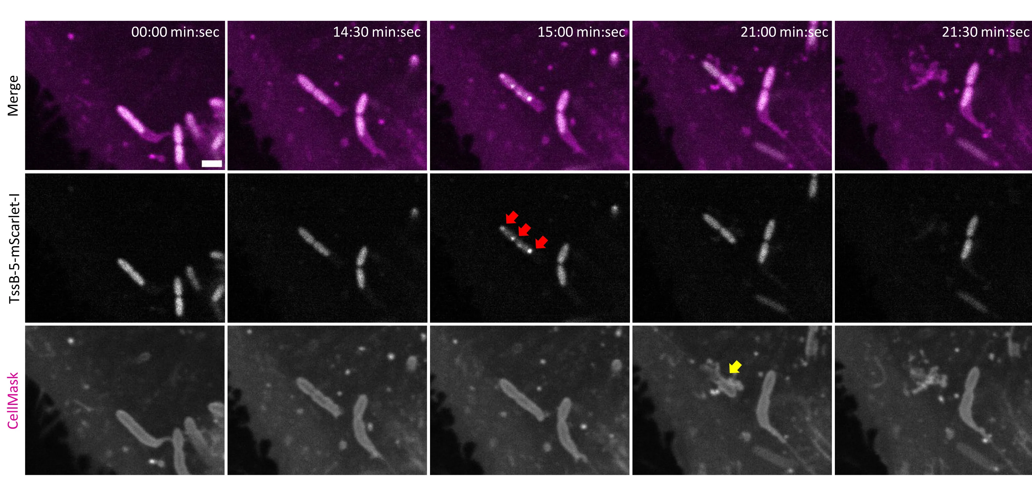Open access visualization of Microscopy, T6SS-5, Protrusion Lysis, A549 Cells, B. thailandensis