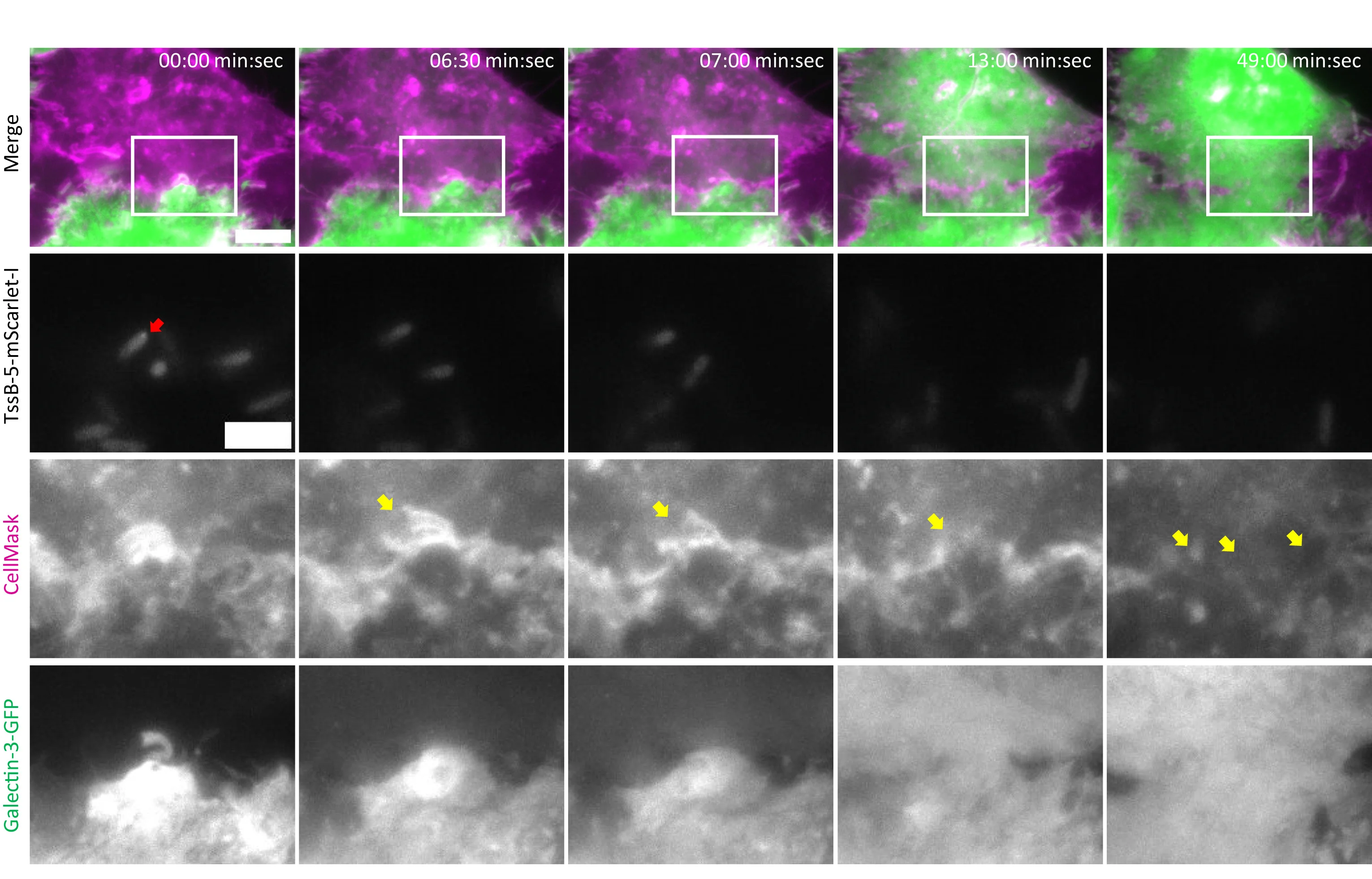 Open access visualization of Microscopy, Protrusion Lysis, MNGC Formation, TssB-5-mScarlet-IB, HeLa Cells
