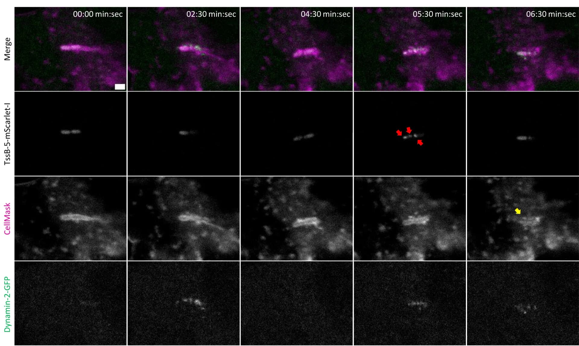 Open access visualization of Microscopy, SK-MEL-2 Cells, Dynamin-2-GFP, B. thailandensis, T6SS-5
