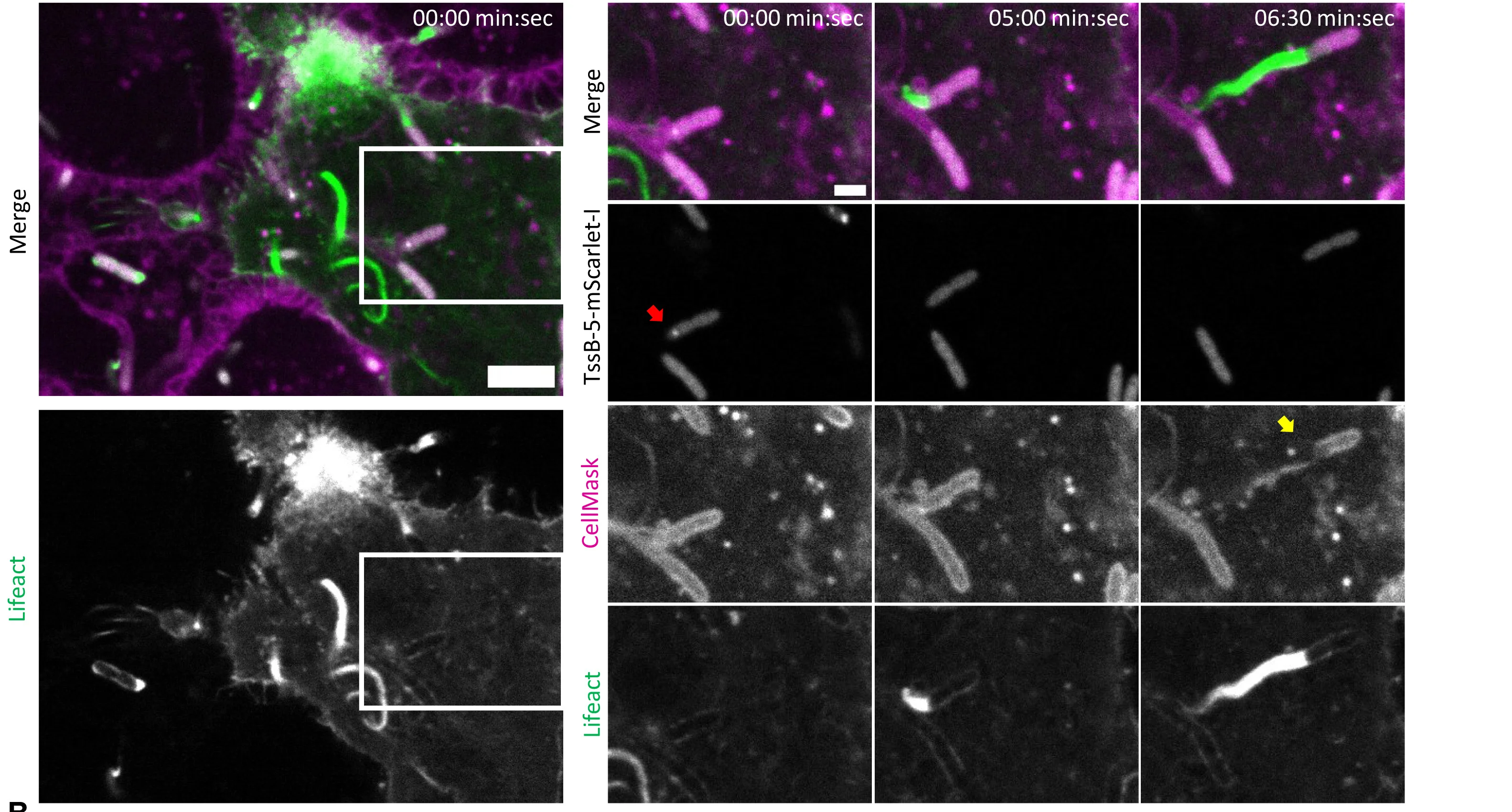 Open access visualization of Microscopy, HeLa-CCL2 Cells, Lifeact-eGFP, TssB-5-mScarlet-IB, T6SS-5