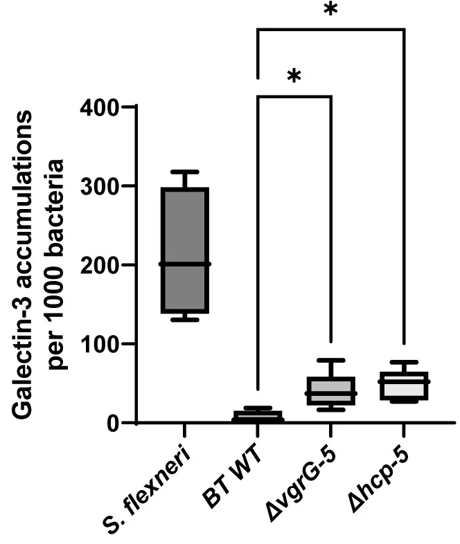 Open access visualization of Box Plot, Galectin-3-GFP, Bacteria, Uninfected Cells, ANOVA