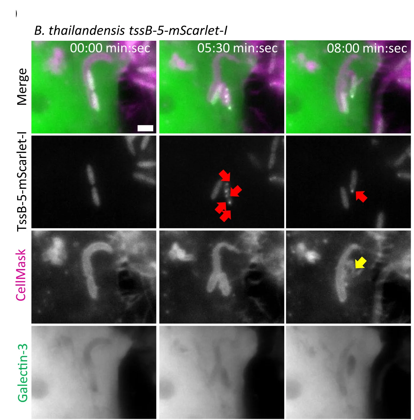 Open access visualization of Microscopy, Galectin-3-GFP, HeLa-CCL2 Cells, B. thailandensis, TssB-5-mScarlet-I