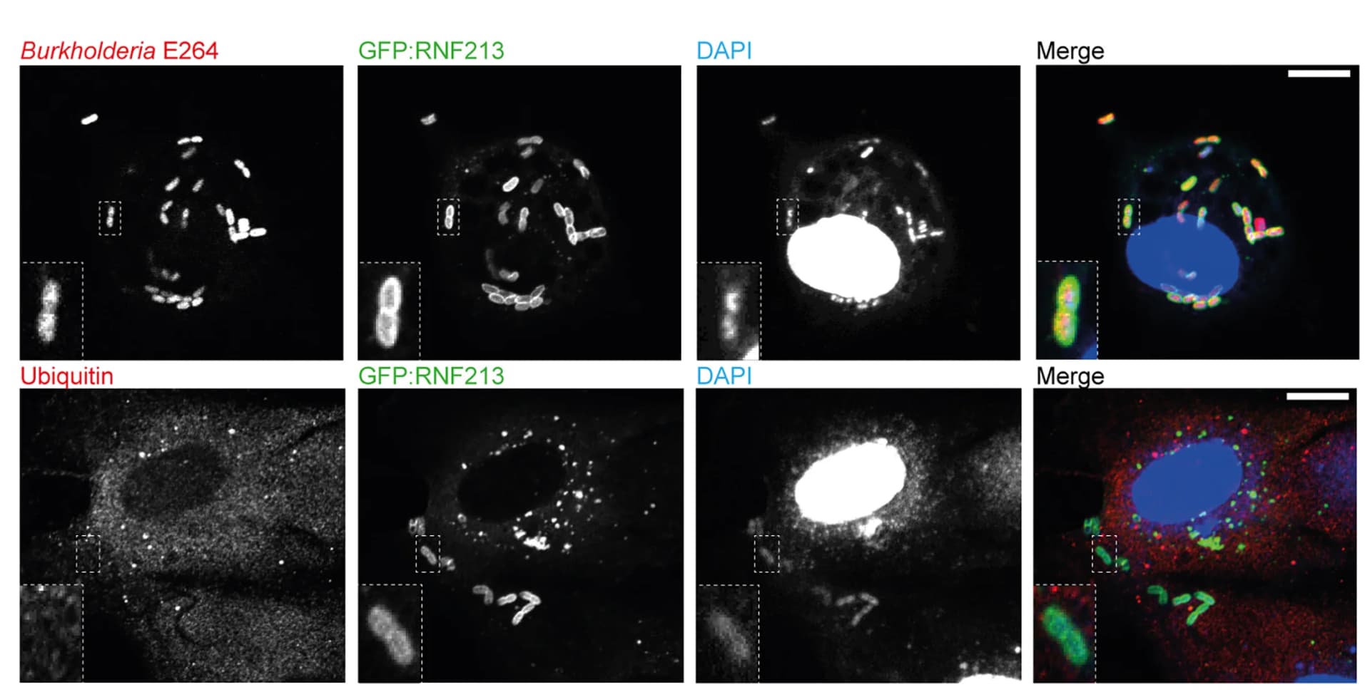 Open access visualization of Microscopy, Confocal Microscopy, RNF213-knockout MEFs, GFP-RNF213, Burkholderia thailandensis