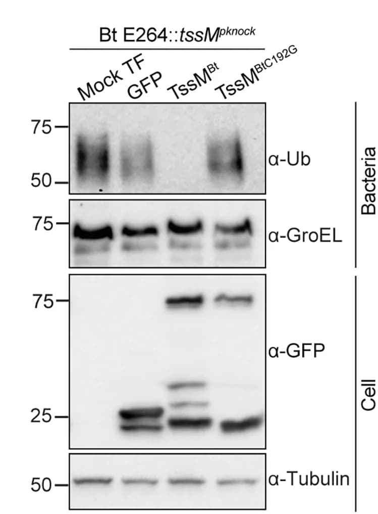 Open access visualization of Gel, Immunoblot, HEK293ET Cells, GFP-tagged effector, Burkholderia thailandensis