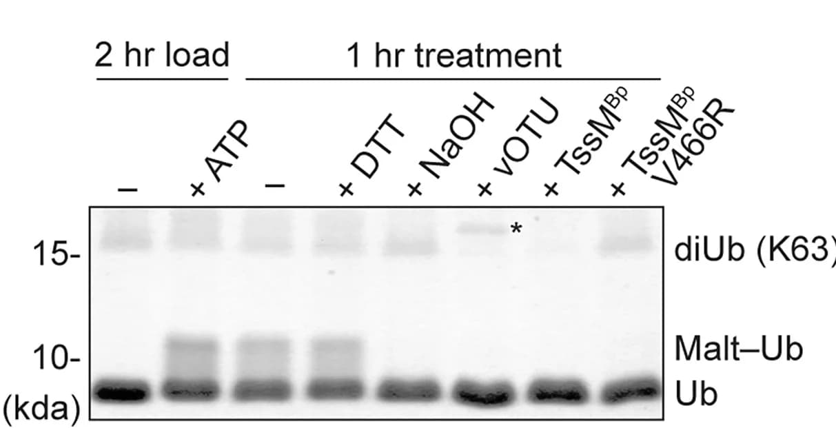 Open access visualization of Gel, Chemical Treatment, Enzymatic Treatment, K63-Linked Di-Ubiquitin, Ester-Linked Ubiquitylated Maltoheptaose