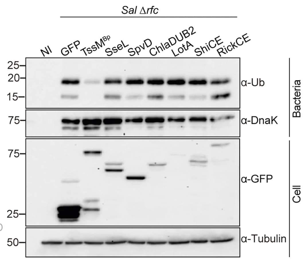 Open access visualization of Gel, Immunoblot Analysis, rfc Salmonella, HEK293ET Cells, GFP-tagged Bacterial Cysteine Hydrolases