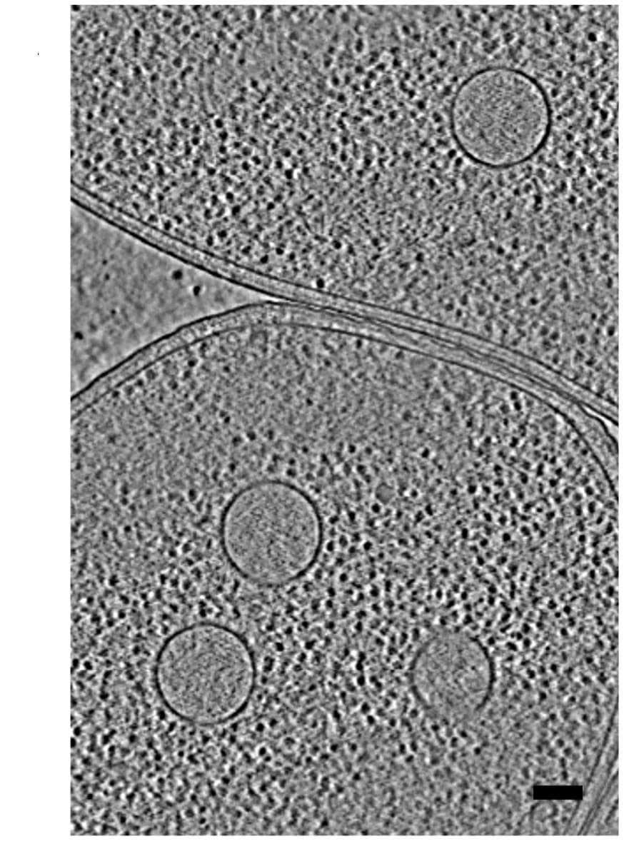 Open access visualization of Microscopy, Tomogram Slice, Segmentation, ChmA Knockdown Cells, DNA-containing Vesicle