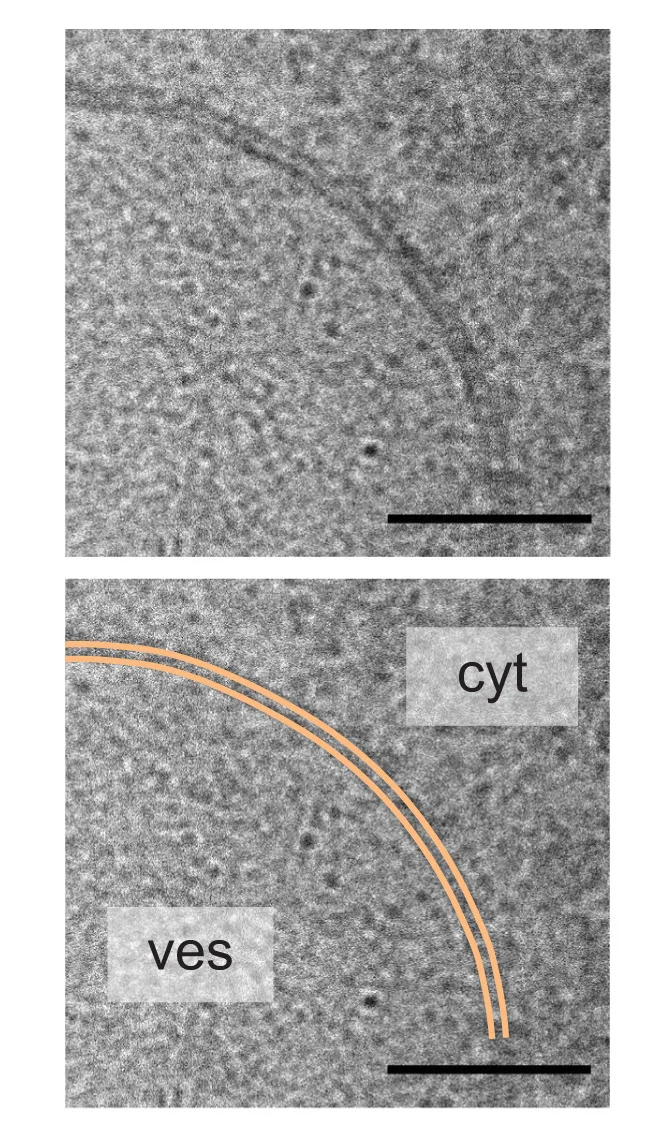 Open access visualization of Microscopy, 2D Projections, Vesicles, Lipid Bilayer, Vesicle Membrane