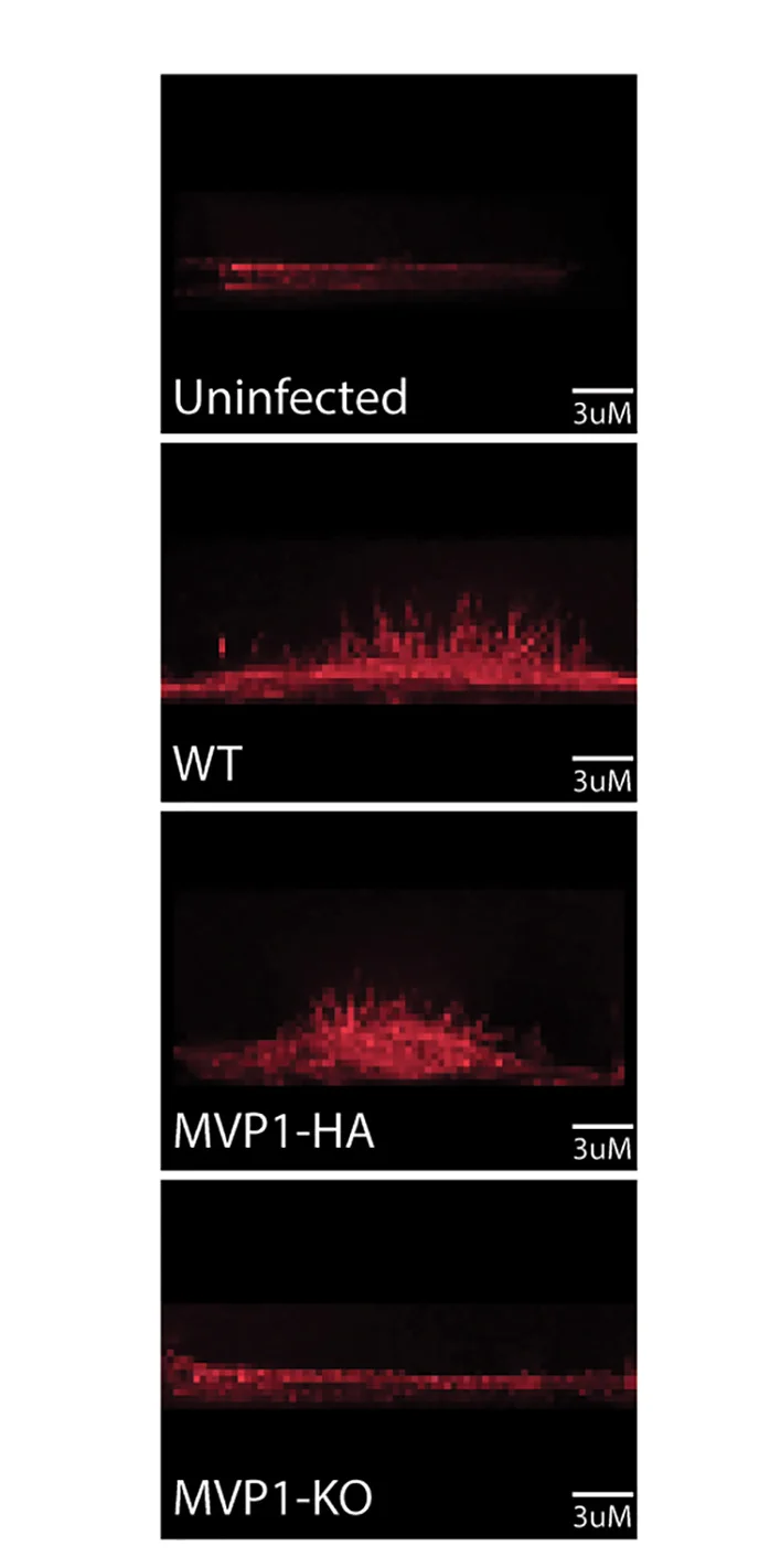 Open access visualization of Microscopy, Epithelial Cells, MVP1-HA, Wild-type, MVP1-KO