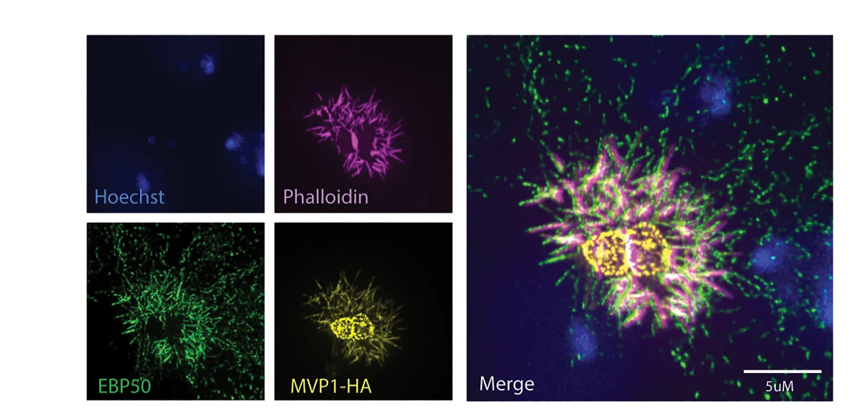 Open access visualization of Microscopy, Immunofluorescence Assay, Epithelial Cells, HCT-8, MVP1-HA