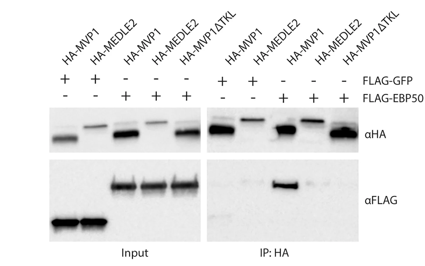 Open access visualization of Gel, HEK Cells, Transfection, HA-MVP1, HA-MEDLE2