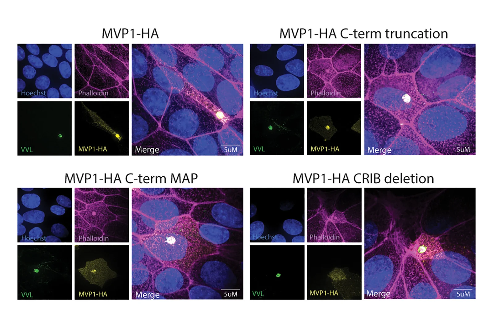 Open access visualization of Microscopy, Epithelial Cells, Infection, Wild-Type, MVP1 Truncation
