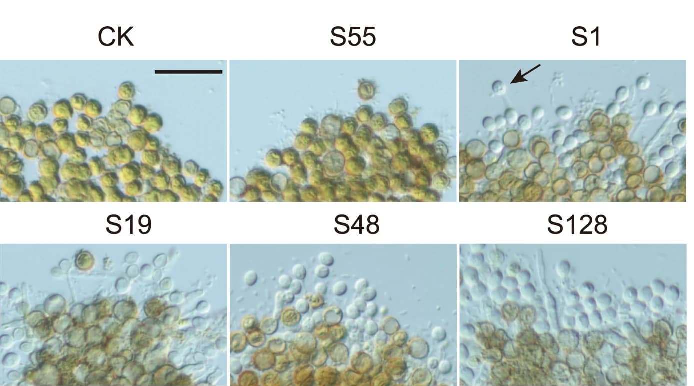 Open access visualization of Microscopy, Sphingomonadaceae, Chlamydospore Germination, Microscopy Observation